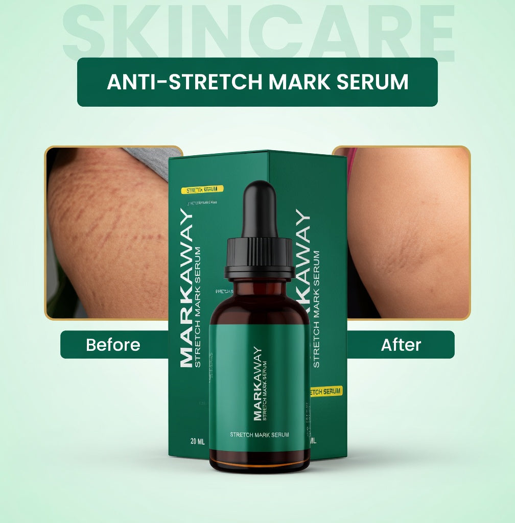 Mark Away – Stretch Mark Serum